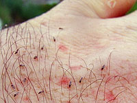 GtB Click on the Picture to see the life cycle of the Sandfly