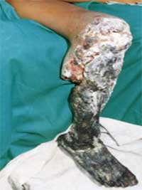 Fer de Lance Tommygoff