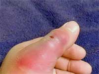 Brown Recluse Spider