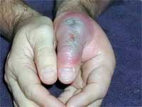 Brown Recluse Spider